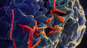 Rio e São Paulo investigam casos suspeitos de ebola com resultados previstos para a próxima semana