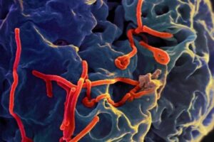 Rio e São Paulo investigam casos suspeitos de ebola com resultados previstos para a próxima semana