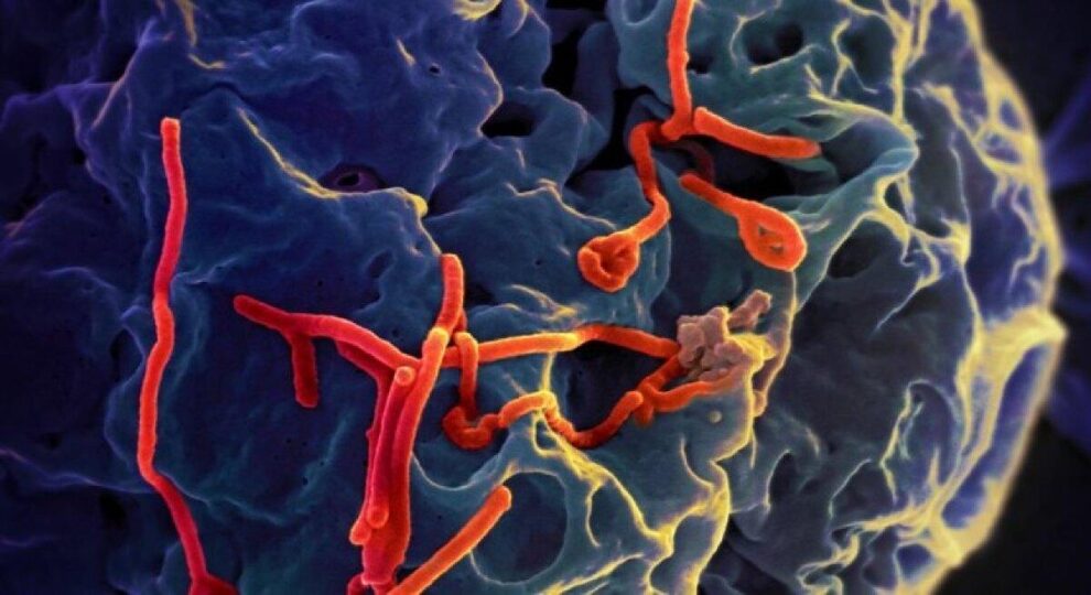 Rio e São Paulo investigam casos suspeitos de ebola com resultados previstos para a próxima semana